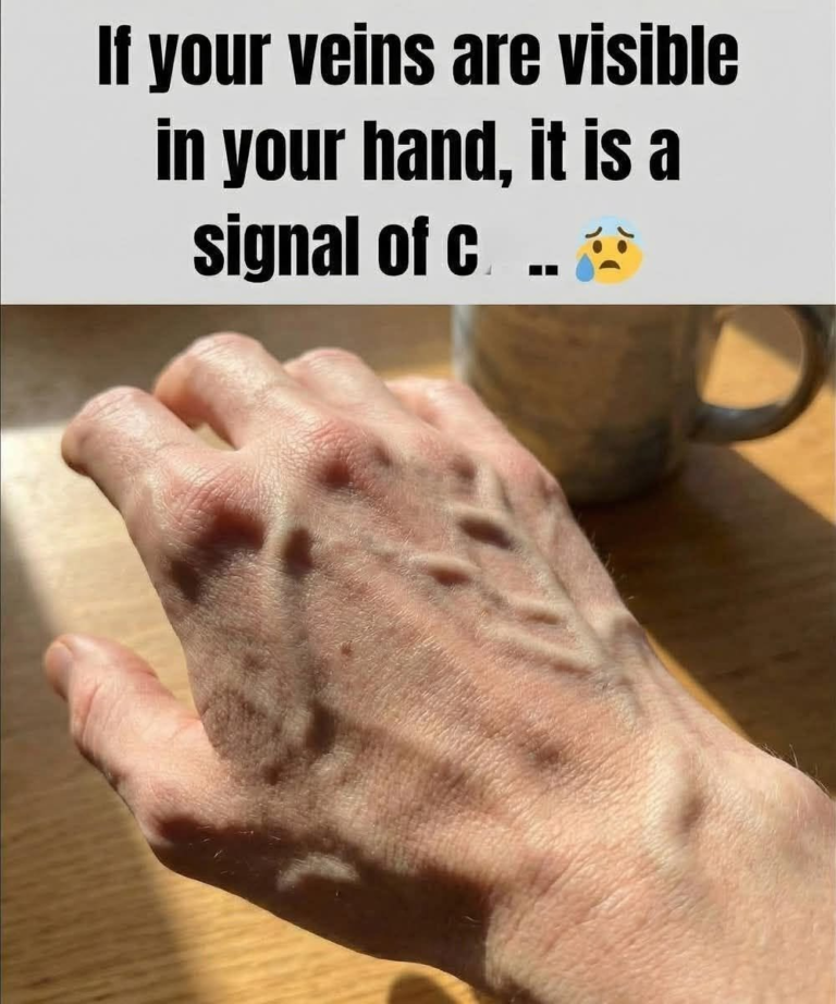 If your veins are visible, it means you are…
