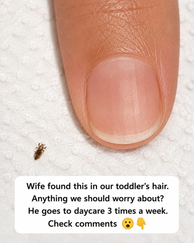 Head Lice: Effective Ways to Treat Them and Help Prevent Future Infestations