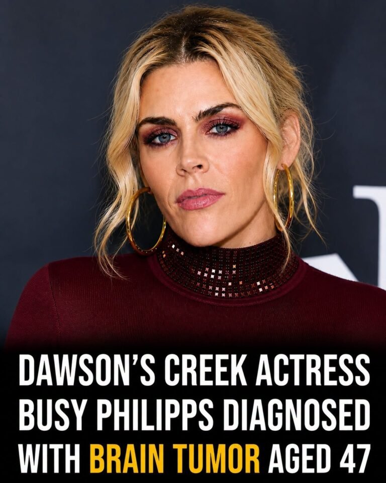 “Dawson’s Creek” actress Busy Philipps has opened up about being diagnosed with a brain tumor at 47.