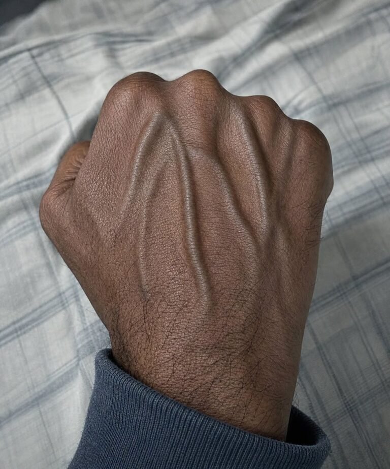 Are Those Visible Veins A Secret Warning Sign Of A Deadly Health Crisis