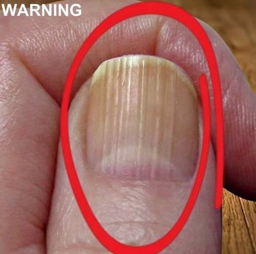 If Your Veins Are Visible in Your Hands, Here’s What It Could Mean for Your Health