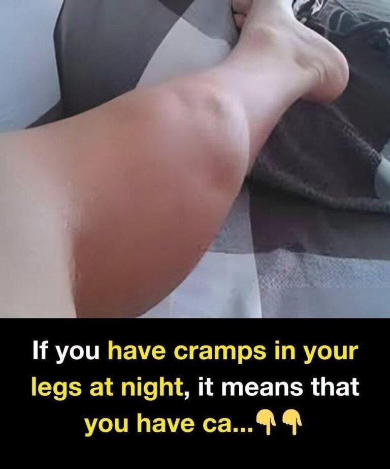 The Midnight Terror: Why Your Leg Cramps Are Actually a Warning Sign From Your Body