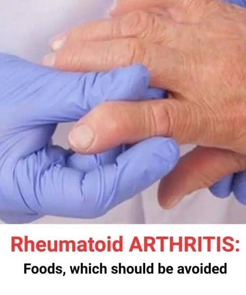 Rheumatoid Arthritis: Foods Which Should Be Avoided
