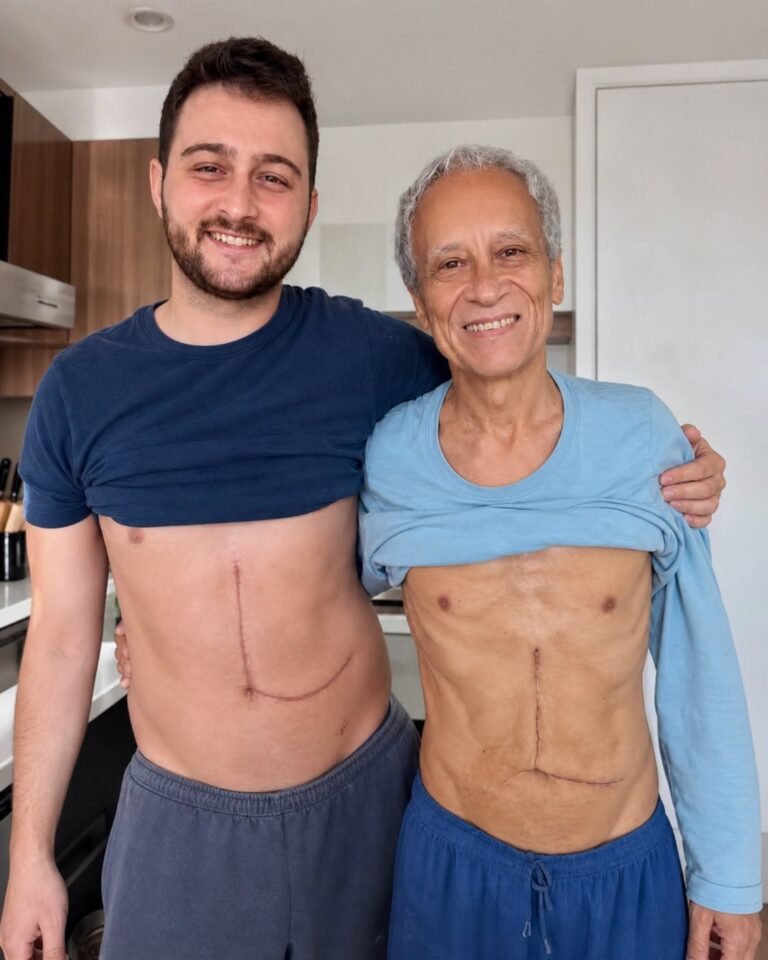 Son who donated part of his liver to his father unfortunately ends up fa… See more