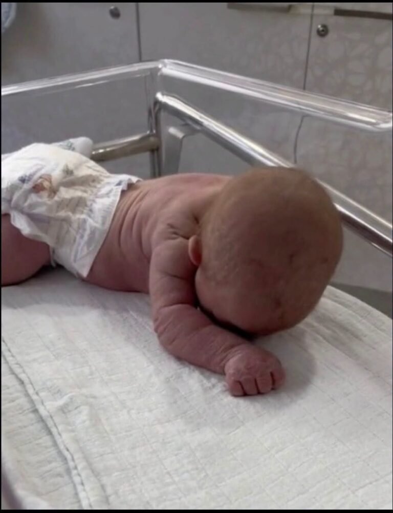 Baby born with an DIU peg… See……