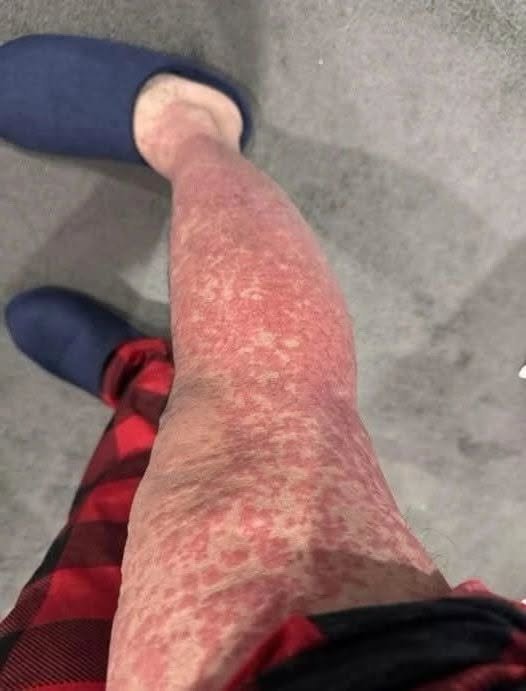 The Shocking Consequences of Sleeping With the…See more