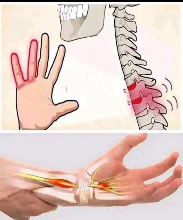Hands Falling Asleep? Here’s What It Really Means